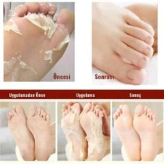 Marlett Foot Çorap Tipi Ayak Peeling Maskesi